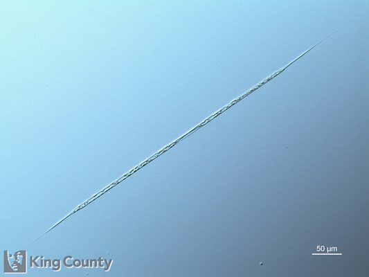 Photo of Rhizosolenia setigera